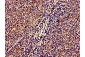 Immunohistochemistry of paraffin-embedded human lymph node tissue using ABIN7176612 at dilution of 1:100 (ZKSCAN3 Antikörper  (AA 8-275))