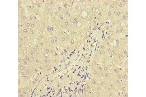 Immunohistochemistry of paraffin-embedded human liver tissue using ABIN7157839 at dilution of 1:100 (Lactoferrin Antikörper  (AA 156-413))