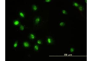 Immunofluorescence of monoclonal antibody to STAT5B on HeLa cell. (STAT5B Antikörper  (AA 1-390))