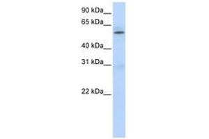 Image no. 1 for anti-Protein Arginine Methyltransferase 3 (PRMT3) (AA 432-481) antibody (ABIN6740658) (PRMT3 Antikörper  (AA 432-481))
