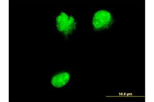 Immunofluorescence of monoclonal antibody to NUP62 on HeLa cell. (NUP62 Antikörper  (AA 423-522))