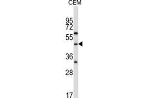 Western Blotting (WB) image for anti-Cbl proto-oncogene C (CBLC) antibody (ABIN2996831) (CBLC Antikörper)