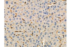 ABIN6259757 and ABIN6276478 at 1/100 staining Mouse liver tissue by IHC-P. (ACTR3 Antikörper  (C-Term))