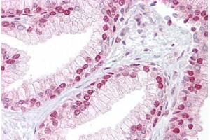 Anti-TCEA1 antibody IHC staining of human prostate. (TCEA1 Antikörper  (AA 71-120))