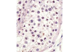 staining MLL3 in human testis tissue sections by Immunohistochemistry (IHC-P - paraformaldehyde-fixed, paraffin-embedded sections). (MLL3 Antikörper  (C-Term))