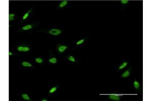 Immunofluorescence of monoclonal antibody to LHX6 on HeLa cell. (LHX6 Antikörper  (AA 274-363))