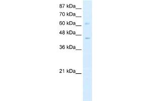 WB Suggested Anti-ZBTB3 Antibody Titration:  0. (ZBTB3 Antikörper  (N-Term))