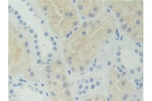 IHC-P analysis of Human Kidney Tissue, with DAB staining. (AHCY Antikörper  (AA 2-432))