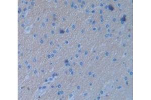 IHC-P analysis of Human Tissue, with DAB staining. (FGF3 Antikörper  (AA 154-232))