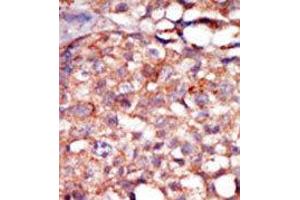 Image no. 2 for anti-Receptor-Interacting Serine-threonine Kinase 4 (RIPK4) (C-Term) antibody (ABIN360126) (RIPK4 Antikörper  (C-Term))