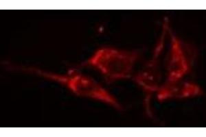 ABIN6275048 staining HuvEc cells by IF/ICC. (GBA3 Antikörper  (Internal Region))