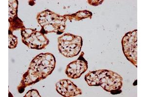 IHC image of ABIN7172786 diluted at 1:400 and staining in paraffin-embedded human placenta tissue performed on a Leica BondTM system. (GATAD2B Antikörper  (AA 58-146))