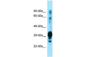 Western Blotting (WB) image for anti-Glycoprotein M6A (GPM6A) (C-Term) antibody (ABIN2790022) (GPM6A Antikörper  (C-Term))
