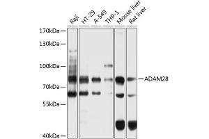 Western blot analysis of extracts of various cell lines, using  antibody (ABIN6132167, ABIN6136531, ABIN6136532 and ABIN6225029) at 1:1000 dilution.