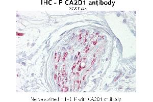 Image no. 1 for anti-Calcium Channel, Voltage-Dependent, alpha 2/delta Subunit 1 (CACNA2D1) (N-Term) antibody (ABIN347205) (CACNA2D1 Antikörper  (N-Term))