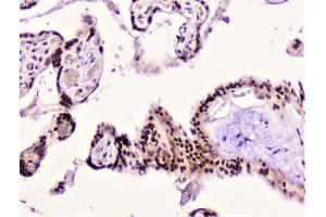 IHC analysis of Rad51 using anti-Rad51 antibody (ABIN6719396).