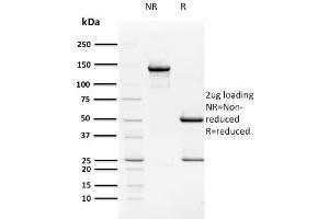 anti-Human Papilloma Virus 16 E2 (HPV-16 E2) antibody