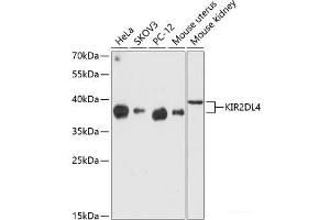 Western blot analysis of extracts of various cell lines using KIR2DL4 Polyclonal Antibody at dilution of 1:3000. (KIR2DL4/CD158d Antikörper)