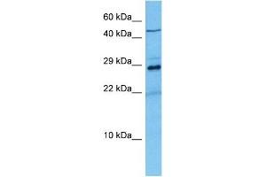 Host:  Mouse  Target Name:  KCNIP2  Sample Tissue:  Mouse Liver  Antibody Dilution:  1ug/ml (KCNIP2 Antikörper  (N-Term))