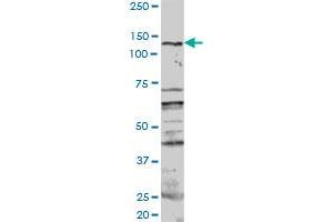 PKN1 MaxPab rabbit polyclonal antibody. (PKN1 Antikörper  (AA 1-942))