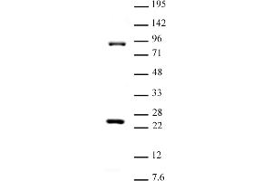 Suz12 antibody (pAb) tested by Western blot. (SUZ12 Antikörper  (C-Term))