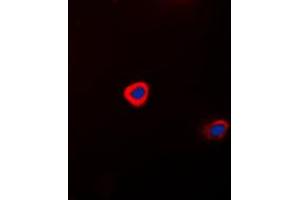 Immunofluorescent analysis of Connexin 43 staining in HeLa cells.