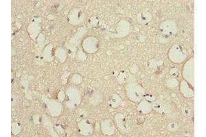 Immunohistochemistry of paraffin-embedded human brain tissue using ABIN7157257 at dilution of 1:100 (KBTBD7 Antikörper  (AA 475-684))