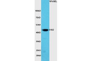 Lane 1:A549 cell lysates probed with Rabbit Anti-hnRNP K Polyclonal Antibody, Unconjugated (ABIN706571) at 1:300 overnight at 4 °C. (HNRNPK Antikörper  (AA 201-300))