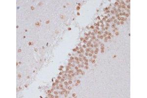 Immunohistochemistry of paraffin-embedded Rat brain using Phospho-Stat3(Y705) Polyclonal Antibody at dilution of 1:100 (40x lens). (STAT3 Antikörper  (pTyr705))