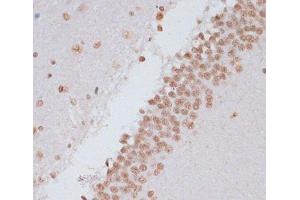 Immunohistochemistry of paraffin-embedded Rat brain using Phospho-Stat3(Y705) Polyclonal Antibody at dilution of 1:100 (40x lens).