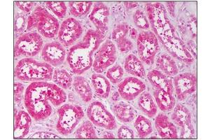 Human Kidney: Formalin-Fixed, Paraffin-Embedded (FFPE) (TNK2 Antikörper  (AA 278-289))