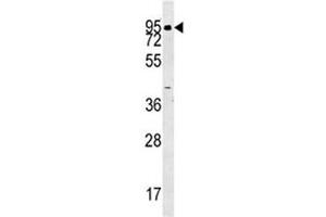 ABP1 antibody western blot analysis in human K562 lysate. (DAO Antikörper  (AA 71-100))