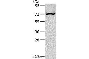Western blot analysis of Mouse kidney tissue, using CPT2 Polyclonal Antibody at dilution of 1:200