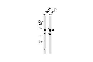 Western Blotting (WB) image for anti-Cholinergic Receptor, Nicotinic, beta 3 (Neuronal) (CHRNB3) (AA 187-200) antibody (ABIN6244215)