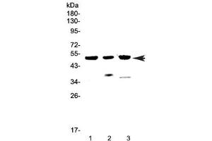 Western blot testing of 1) human MCF7, 2) rat heart and 3) mouse heart lysate with HTRA1 antibody at 0. (HTRA1 Antikörper)