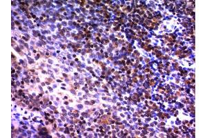 Formalin-fixed, paraffin-embedded human tonsil stained with NuMA Monoclonal Antibody (A73-B/D12) (NUMA1 Antikörper)