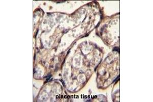 Immunohistochemistry (Paraffin-embedded Sections) (IHC (p)) image for anti-Insulin-Like Growth Factor 2 (IGF2) (AA 39-68) antibody (ABIN650616)