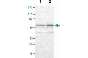 Western Blot analysis of Lane 1: RT-4 and Lane 2: U-251MG sp cell lysates with RBM23 polyclonal antibody . (RBM23 Antikörper)