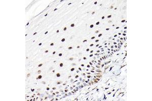 Immunohistochemistry of paraffin-embedded human normal cervix using CTCF Rabbit pAb (ABIN6130043, ABIN6139180, ABIN6139182 and ABIN6217207) at dilution of 1:100 (40x lens). (CTCF Antikörper  (AA 1-260))