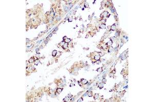 Immunohistochemistry of paraffin-embedded mouse testis using Smac/Diablo Rabbit pAb (ABIN3023378, ABIN3023379, ABIN3023380 and ABIN6219667) at dilution of 1:100 (40x lens). (DIABLO Antikörper  (AA 1-232))