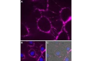 Expression of P2RX7 in rat brain glioma (C6) cells - Cell surface detection of P2RX7 in intact living rat C6 cells. (P2RX7 Antikörper  (Extracellular Loop) (Atto 633))