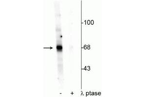 Western blot of Drosophila lysate showing specific labeling of the ~68 kDa AKT protein phosphorylated at Thr342 in the first lane (-). (AKT1 Antikörper  (pThr342))