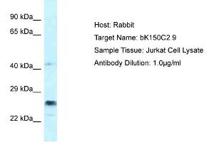 Host: Rabbit Target Name: bK150C2. (bK150C2.9 (C-Term) Antikörper)