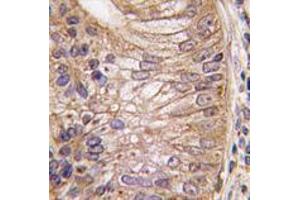 Image no. 1 for anti-Prostate Stem Cell Antigen (PSCA) (Middle Region) antibody (ABIN356897) (PSCA Antikörper  (Middle Region))