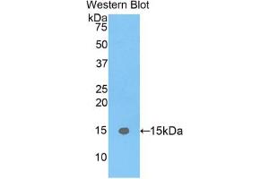 Western blot analysis of the recombinant protein. (FABP5 Antikörper  (AA 2-135))