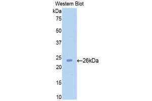 Detection of Recombinant SIRT4, Rat using Polyclonal Antibody to Sirtuin 4 (SIRT4) (SIRT4 Antikörper  (AA 60-255))