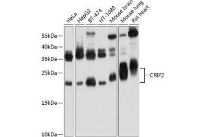 Western blot analysis of extracts of various cell lines, using CRIP2 Antibody (ABIN6130132, ABIN6139042, ABIN6139043 and ABIN6224870) at 1:1000 dilution. (CRIP2 Antikörper  (AA 1-208))