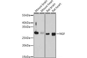 Western blot analysis of extracts of various cell lines using NGF Polyclonal Antibody at dilution of 1:1000. (Nerve Growth Factor Antikörper)