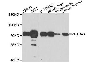 Western blot analysis of extracts of various cell lines, using ZBTB48 antibody.