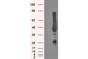 Western Blotting (WB) image for anti-Carbonic Anhydrase IX (CA9) antibody (ABIN1497095) (CA9 Antikörper)